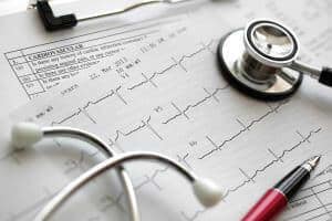 Cardiogram pulse trace and stethoscope concept for cardiovascular medical exam